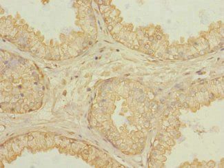 KLHL13 Antibody