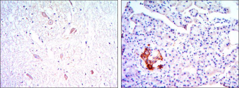 KLHL13 Antibody