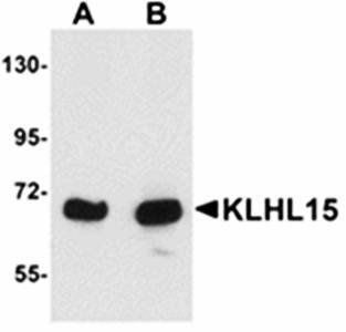 KLHL15 Antibody