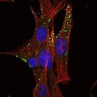 KLHL1 Antibody