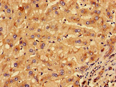 KLHL2 Antibody