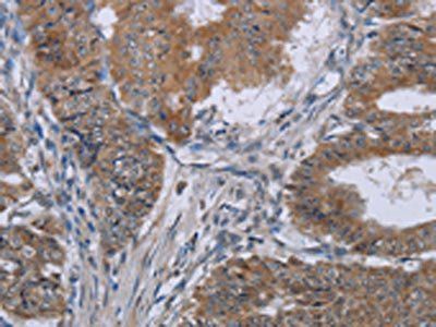 KLHL2 Antibody