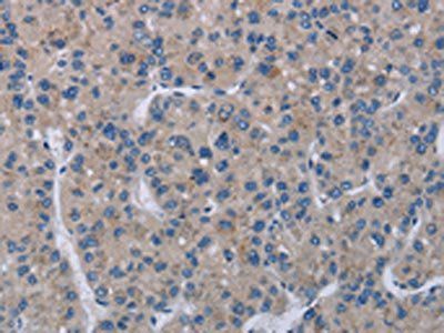 KLHL2 Antibody