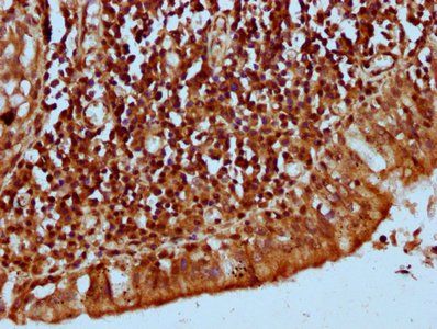 KLHL20 Antibody