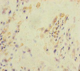 KLHL26 Antibody