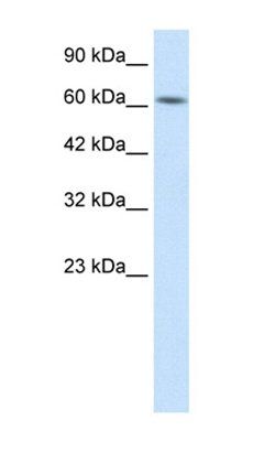 KLHL28 antibody