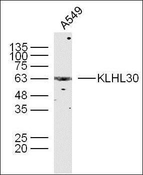 KLHL30 antibody