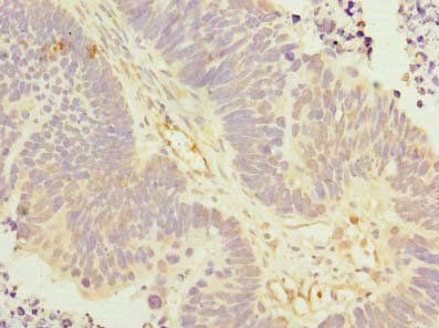 KLHL42 Antibody
