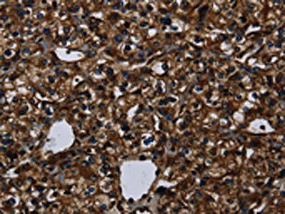 KLK14 Antibody