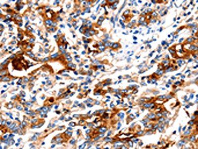 KLK15 Antibody