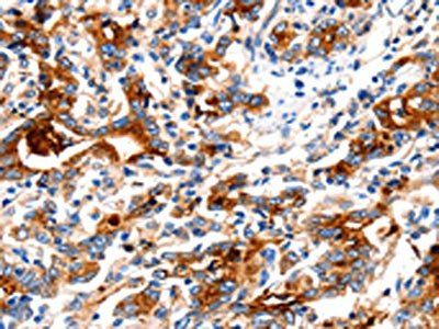 KLK15 antibody