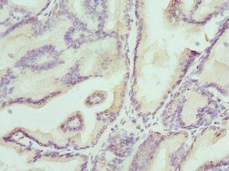 KLK4 Antibody
