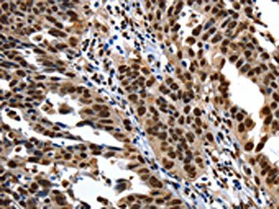 KLK7 Antibody