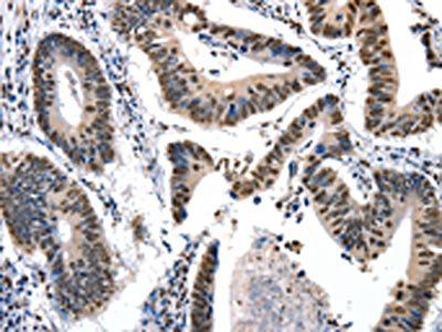 KLK7 Antibody