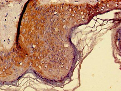 KLK8 Antibody