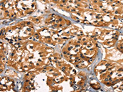 KLRC1 Antibody