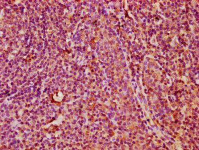 KLRC3 Antibody