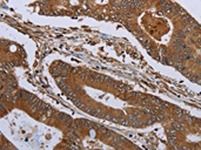 KLRF1 Antibody