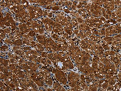 KLRF1 Antibody