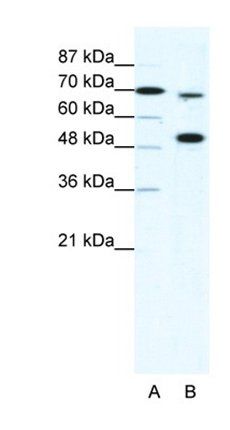 KMT2B antibody