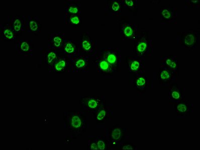 KMT2B antibody