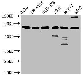 KMT2E antibody