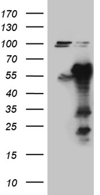 KMT5A antibody