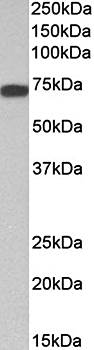 KNG1 antibody