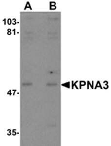 KPNA3 Antibody