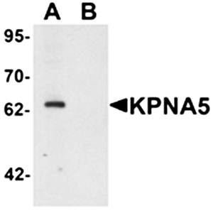 KPNA5 Antibody