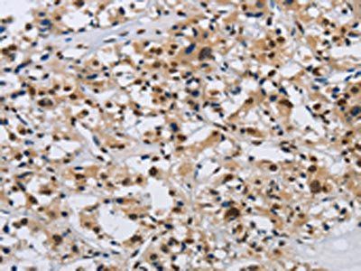 KPNB1 Antibody