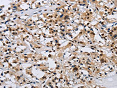 KPNB1 antibody