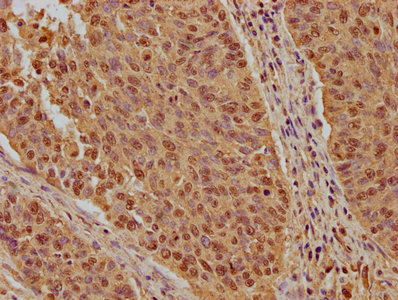 KPNB1 antibody