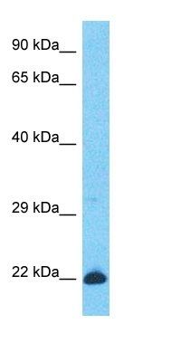 KR261 antibody