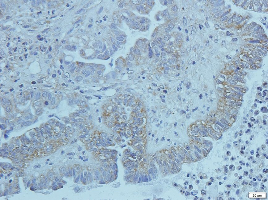 KREM1 antibody