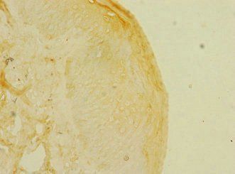 KREMEN1 Antibody