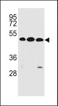 KREMEN2 antibody