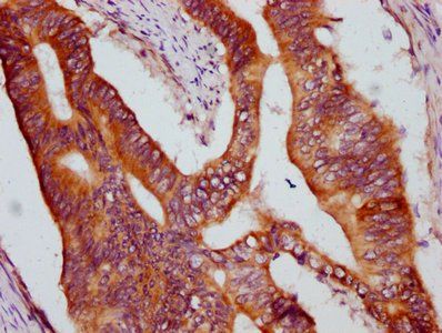 KRIT1 Antibody