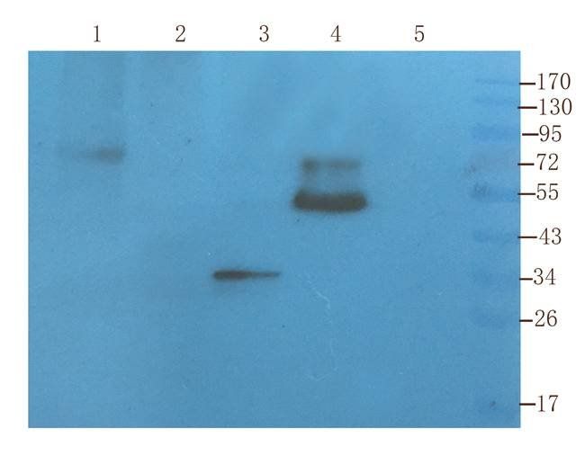 Krox-20 (EGR2) antibody