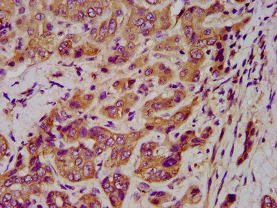 KRT1 Antibody