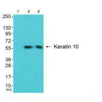 KRT10 antibody