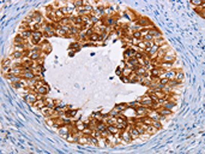 KRT13 Antibody