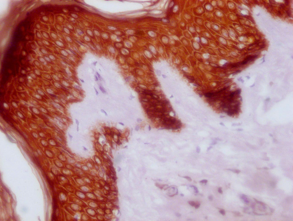 KRT14 antibody