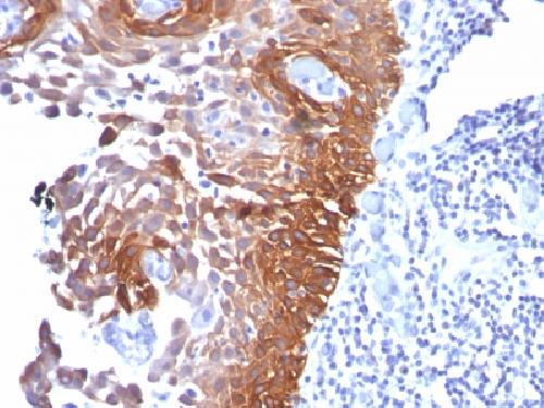 KRT17 Antibody