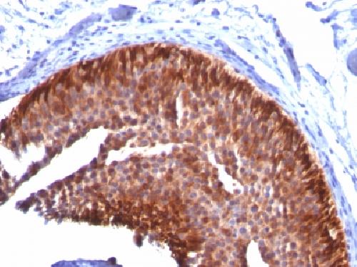 Cytokeratin 17 (CK17) (Basal Epithelial Marker) Antibody