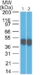 Cytokeratin 18 (KRT18) Antibody