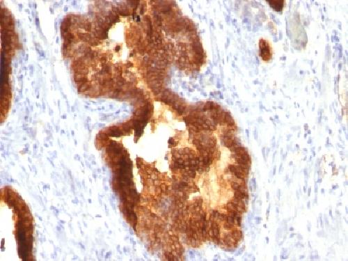KRT18 Antibody