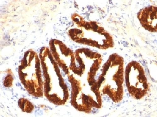 KRT18 Antibody
