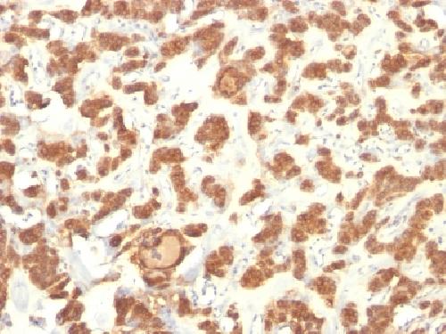 KRT18 Antibody