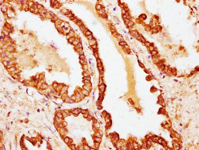 Krt18 Antibody